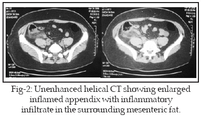 Noncontrast Helical Ct