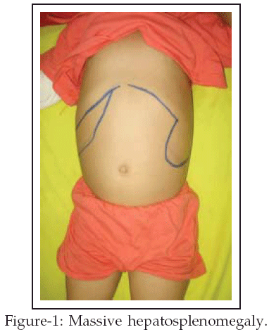 Her complete blood count Complete Blood Count. Her complete blood count